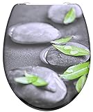 SCHNELLVERSCHLUSS: Einfaches und schnelles Lösen vom WC-Sitz für eine komfortable und hygienische Reinigung; passend für alle handelsüblichen WC-Becken