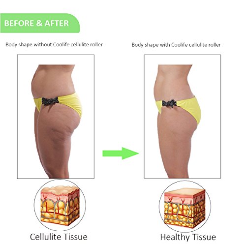Coolife Fascia Muscle Roller - Cellulite Massager - Fascia Roller For Cellulite And Sore Muscles - Neck, Leg, Back, Body Roller Deep Tissue Massage Stick Tools - 3 Balls Size Version #TOP7