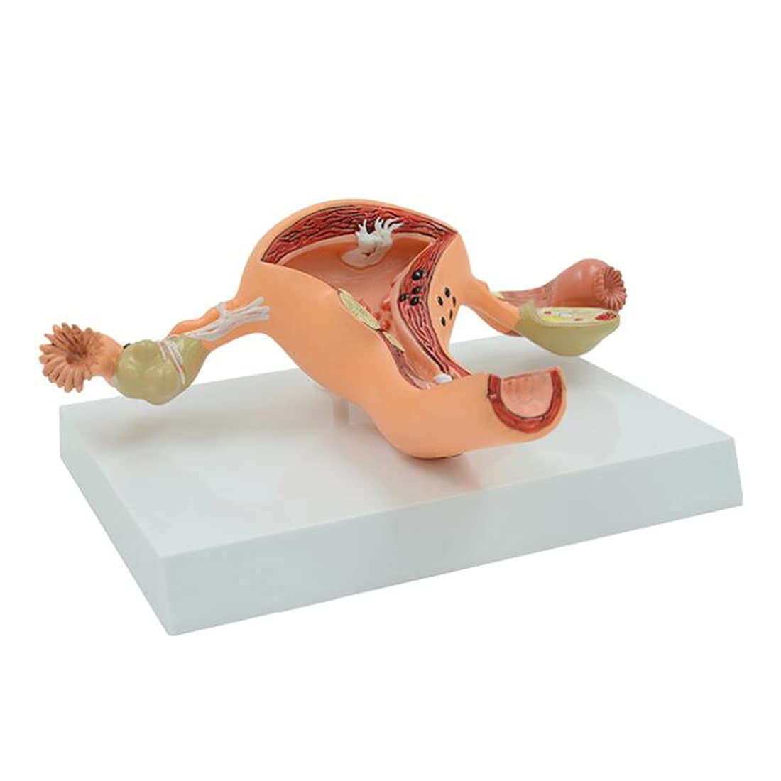 XHLLX Pathology uterus anatomical model, ovarian and uterus model, human uterine model model of female reproductive system