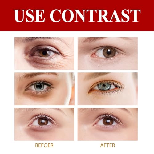 Multi-Peptide Eye Serum,Under Eye Serum,Anti Aging Eye Cream,Eye Cream for Dark Circles and Puffy Eyes,Eye Bags Remover,Firming Eye Cream,Multi-Peptide Eye Wrinkle Cream Smoothing & Firming Skincare - Image 3