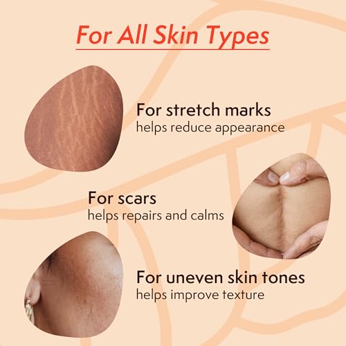 Nature Spell Stretch Mark Body Oil, Strengthens Skin Elasticity & Helps With the Appearance of Stretch Marks and Scars, Infused With Vitamin E, Vegan, 100ml