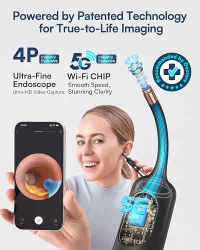 Image of Bebird Earsight Ultra 2K Ear Wax Removal Tool Camera,Pain-Free Ear Cleaner with HD Otoscope,Visual Ear Pick Tweezers, Safe Silicone Tips,Ear Cleaning Kit for Family, FSA HSA Eligible (Green)