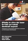 Effetto in vitro del laser Er:YAG sui tubuli dentinali esposti: (Valutazioni al microscopio elettronico a scansione e al microscopio stereoscopico)