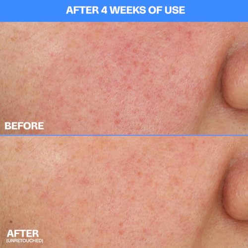 Image of MAMONDE Calming Shot Blue Chamomile Azulene Facial Serum | Soothing, Lightweight Korean Skincare Serum For Sensitive Skin with Niacinamide | Calm Visible Redness | Suitable for Acne Prone Skin