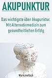  Akupunktur: Das wichtigste über Akupunktur - Mit Alternativmedizin zum gesundheitlichen Erfolg