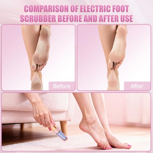 Image of Pedicure Tool, Foot Callus Remover, Electric Pedicure Set, Foot Care, Removes Rough Dead Skin on The Feet, Making Your Feet Smooth. (Pink)