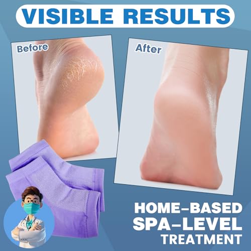 Image of TEAWOO 6 Pairs Purple Moisturizing Heel Socks for Cracked Heel Treatment