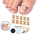 GEMSANVA Ingrown Toenail Corrector Set with Correction Strips,Professional Ingrown Toenail Tool kit,Curved Toenails Corrector Patch,For Home Pedicure Care