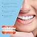 Silicone Denture Set For Teeth Beauty, Natural Smile, Covers Gaps, Comfortable Material, Easy To Use(1PC)