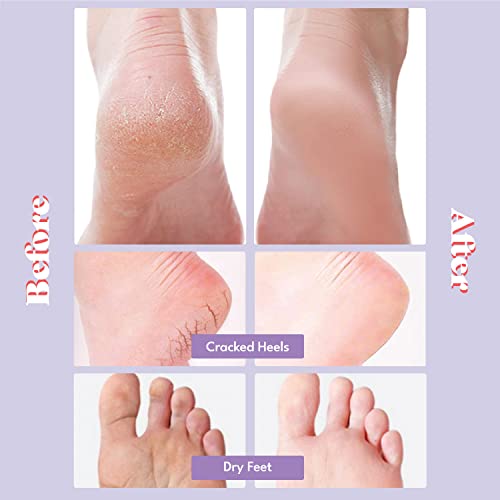 Toi:L Extra Silky Foot Mask 5 Pairs, Post-Peeling Foot Care Treatment, Moisturizing Socks with Guerande Salt & Sweet Almond Oil for Dry Feet, Cracked Heels, and Callus - Image 3
