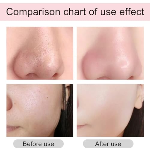 Solución Peeling AHA 30% + BHA 2%,Solución Exfoliante,Combate las Imperfecciones Reduce la Congestión de los Poros y las Líneas Finas,2 Pcs - imagen 3