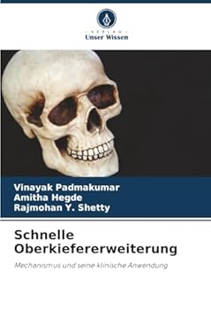 Paperback Schnelle Oberkiefererweiterung [German] Book