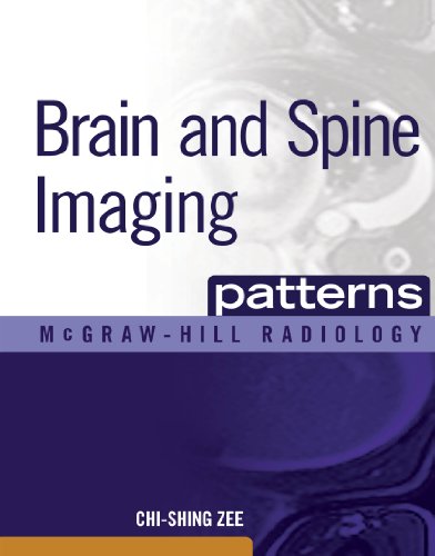 Brain and Spine Imaging Patterns: BRAIN & SPINE IMAGING (EBOOK) (McGraw-Hill Radiology)