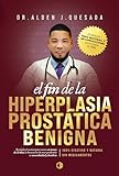 EL FIN DE LA HIPERPLASIA PROSTÁTICA BENIGNA: (Método del Dr. Alden J. Quesada para tratar la HPB de forma 100% Natural)
