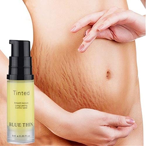 Preisvergleich Produktbild Luccase 6 ml Schwangerschaftsstreifen Entfernung Creme Aknenarbe Dehnungsstreifen Creme Fett Narbe Striae Gravidarum Repair Behandlung