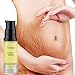 Produktbild Luccase 6 ml Schwangerschaftsstreifen Entfernung Creme Aknenarbe Dehnungsstreifen Creme Fett Narbe Striae Gravidarum Repair Behandlung