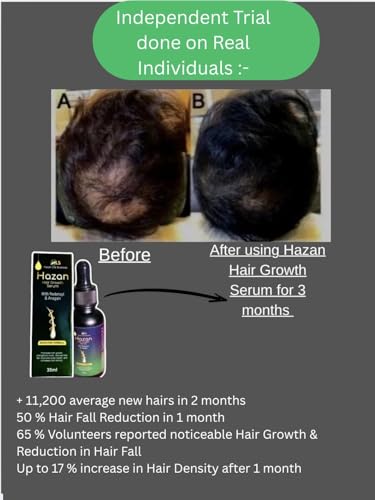 Image of Hazan Hair Growth Serum With 4-in-1 Advanced Formulation-Redensyl + Anagain + Niacinamide + Caffeine | Boosts Hair Growth & Density | Prevents Hair Fall by 90%,tested on Real individuals | Prevents Rough,Frizzy Hairs,Restores Smoothness | Non-Greasy | For Men & Women | 30ml