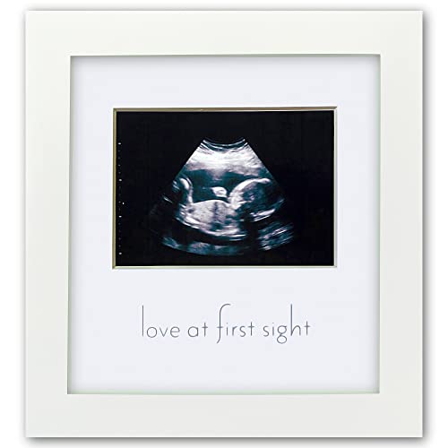 Image of Green Pollywog Sonogram Photo Display | White Ultrasound Frame | Pregnancy Gift for First-Time Moms, Parents & Grandparents | Nursery Decor