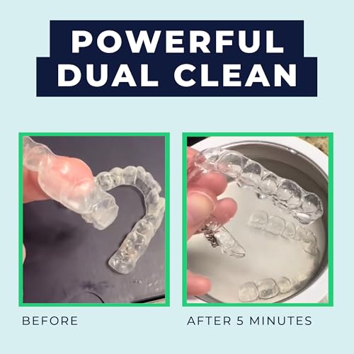 Fresh Knight Ultrasonic Retainer Cleaner, 45kHz Retainer Cleaner Machine for Denture Cleaner, Retainer Cleaner, Mouth Guard Cleaner, Night Guard Cleaner, Denture Cleaner with 200ML Dental Cleaning Pod