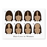 Posterazzi Hair Loss Poster Print by Gwen Shockey/Science Source, (24 x 18), Varies