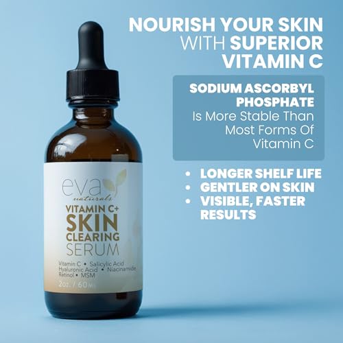 Image of Vitamin C Serum for Face with Retinol & Salicylic Acid - Skin Clearing Acne Spot Treatment with Niacinamide, Hyaluronic Acid, MSM - Anti-Aging Facial Serum for Dark Spots and Blemishes, 2 Fl Oz