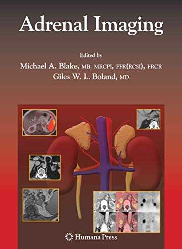 Adrenal Imaging (Contemporary Medical Imaging)