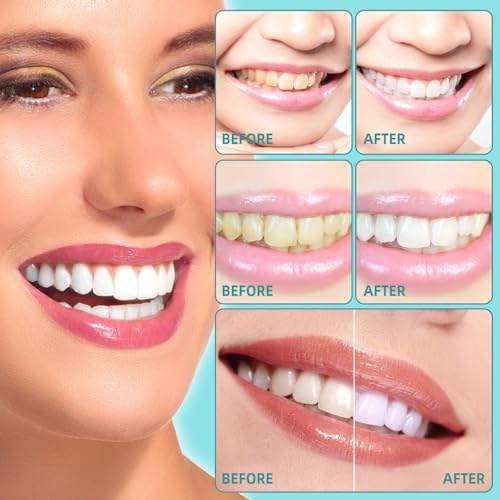 Kokosnuss-Ziehöl für die Zähne,Kokosöl Zähne 237ml,Coconut Pulling Oil,Ölziehen mit Zungenschaber - Natürliche Mundpflege, frischen Atem,Zahnaufhellung und Zahnfleischgesundheit,Alkoholfrei