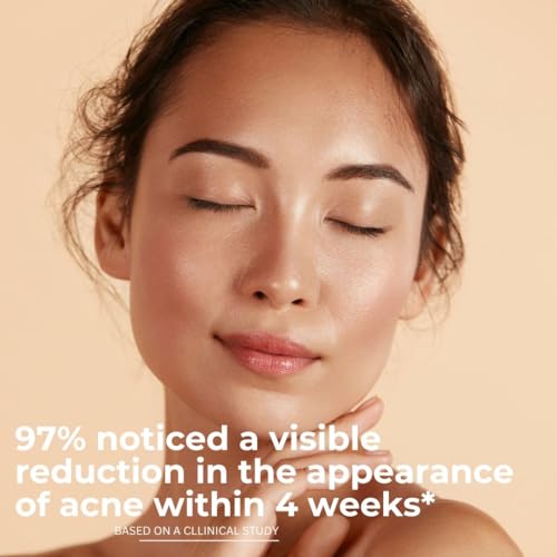 Acne Cream Treatment - 4X Strength, White/yellow, 50 ml (Pack of 1) - Image 4
