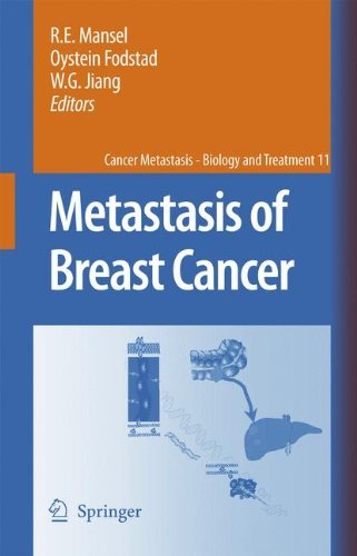 Metastasis of Breast Cancer (Cancer Metastasis - Biology and Treatment Book 11)