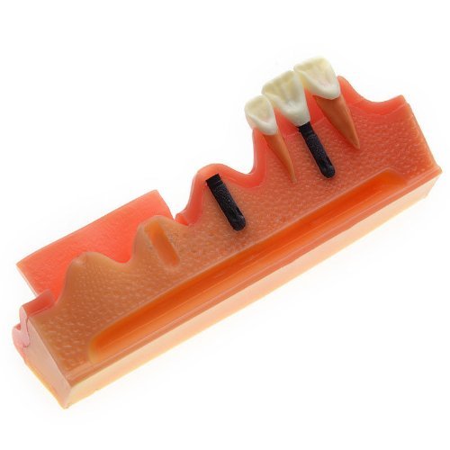 The 18 Best Teeth Washer Grommets of 2024 [Verified] Cherry Picks