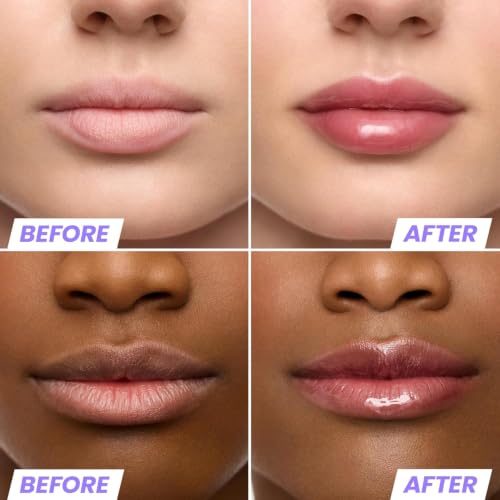 Image of Wonderskin Lip Oil Rehab Serum - Tinted Lip Oil, Hydrating Lip Serum