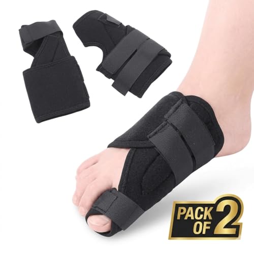 Image of Pack of 2 Orthopedic Toe Separators for Bunion Correction & Toe Alignment | Adjustable Bunion Corrector Splint for Hallux Valgus Pain Relief | Comfortable Toe Straightener Support for Men & Women (Black) (BLACK)