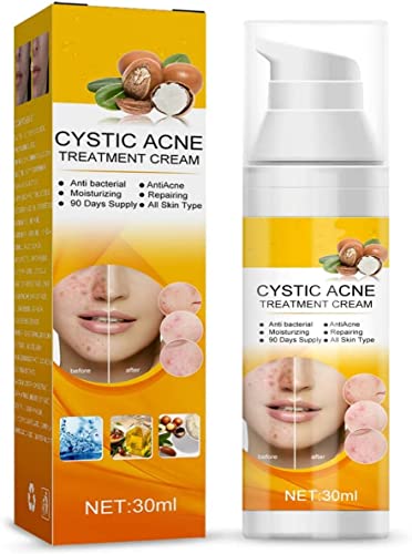 Crema para el tratamiento del acné, crema para eliminar cicatrices de acné quístico, reparación de espinillas quísticas, cuidado facial antibacteriano hidratante, para adolescentes y adultos...