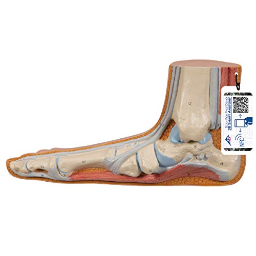 Image of 3B Scientific M31 Flat Foot (Pes Panus) - 3B Smart Anatomy