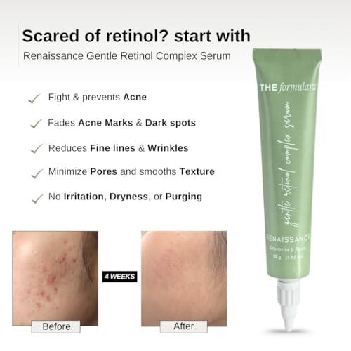 Image of The Formularx 0.1% Retinol + 0.5% Granactive Retinol Gentle Complex Serum With Niacinamide & Bakuchiol | For Acne, Acne Marks, Dark Spots, Wrinkles, & Pores | Anti Aging & Brightening Face Serum | 30G