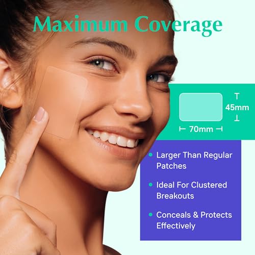 Voibon XXL Acne Patches - Hydrocolloid Pimple Covers for Face & Body Breakouts | Cystic Zit Treatment | Vegan (8ct)
