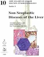 Non-Neoplastic Diseases of the Liver (AFIP Atlas of Tumor