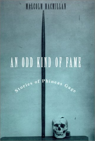 An Odd Kind of Fame