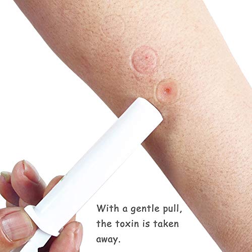 Extrator de veneno, Andoer Bomba extratora portátil Wild Venom Suprimentos de segurança de primeiros