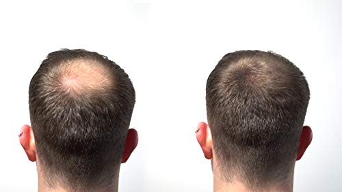 HairLab 100% Organic Hair-Thickening Keratin Fibres for Concealing Hair Loss and Thinning Hair - 30g Medium Brown - Image 3