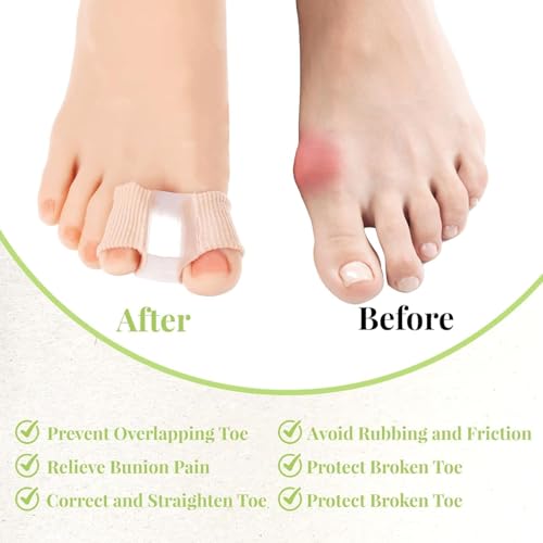 Image of LUVINA Gel Toe Separators for Bunions - Breathable Fabric Toe Spacers with Gel Lining for Bunion Pain Relief & Hammer Toe Correction - 2-Loop Design for Men & Women (2, S + L)