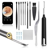 耳かき カメラ付き【Amazon.co.jp限定】カメラ付き みみかき カメラ 耳掃除 カメラ付き耳かき メカニカルアーム付き 3.5mm極細レンズ