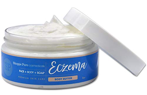 Shoppe Pure Eczema Body Butter and Face Cream - All Natural, Moisturizing Therapy - Anti-Itch, Heals Dry Skin, Soothes Redness - For Kids and Adults - Fragrance Free - 8 oz.