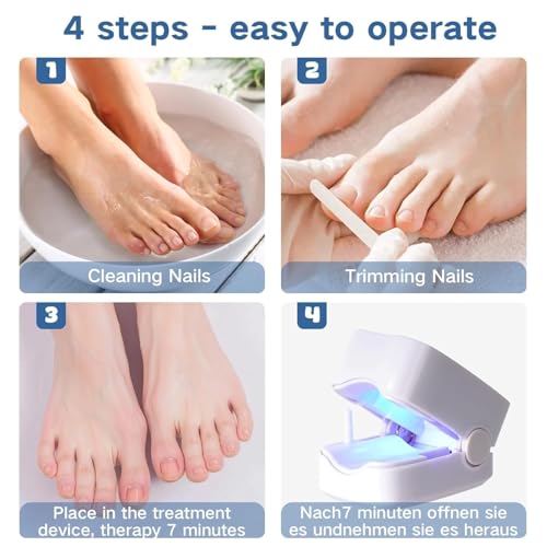 Dispositivo Trattamento Laser Micosi Unghie, Dispositivo Laser Dei Funghi Unghie Indolore Per Mani E Punta Migliorare Unghie Danneggiate 7 Minuti Al Giorno, Luce Infrarossa 910Nm E Blu 460Nm - 5