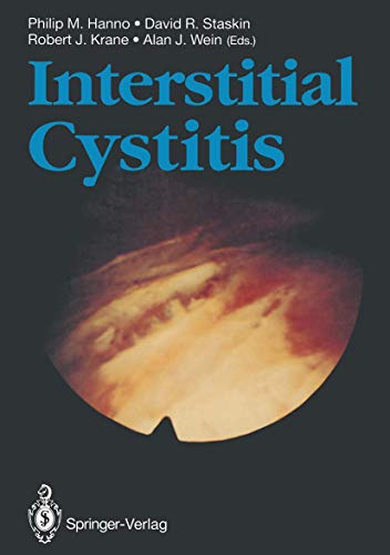 Interstitial Cystitis view 2