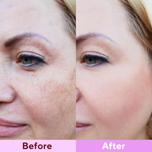 Nityrliv Bio-Collagen Real Deep Mask, 4 Pack Overnight Hydrating Face Mask for All Skin Types,Original Hydrating Collagen Face Mask