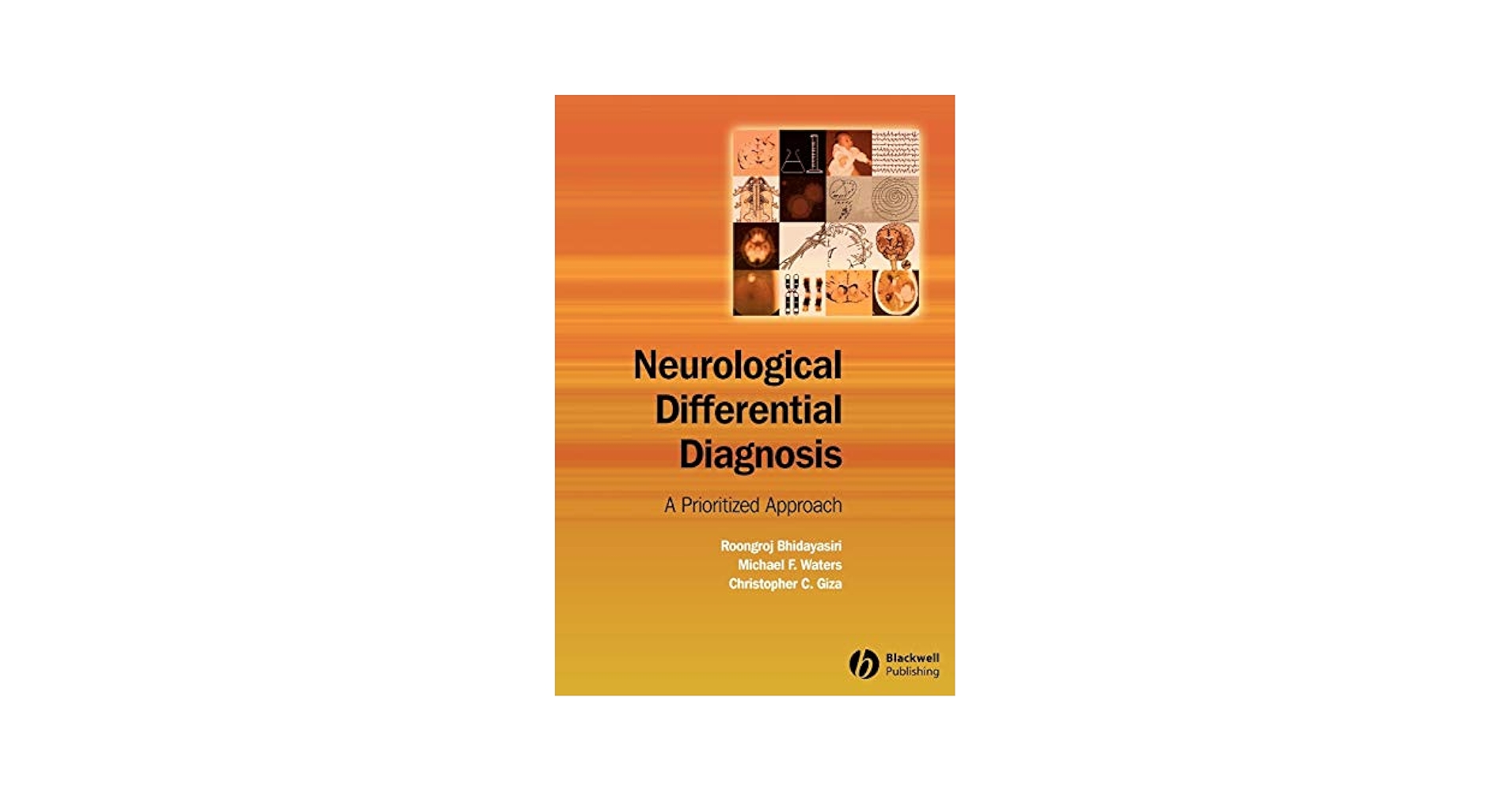 Ｆｒｏｎｔｉｅｒｓ　ｉｎ　Ｐａｒｋｉｎｓｏｎ　Ｄｉｓｅａｓｅ ９-１/メディカルレビュ-社（大型本） Different z-score cut-offs for striatal binding ratio (SBR