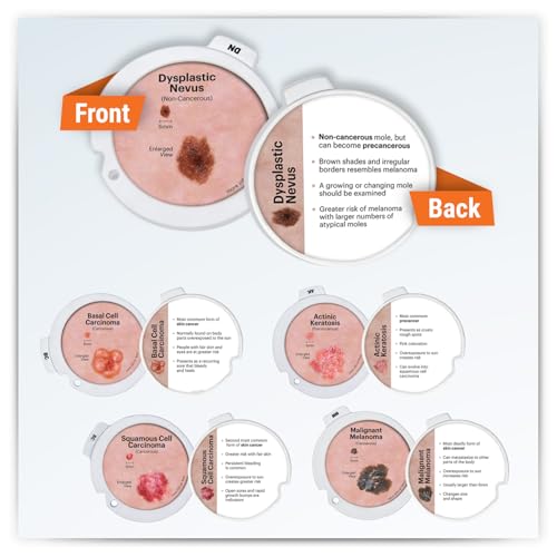 Image of GPI Anatomicals Skin Cancer Model with Precancerous & Cancerous Skin Lesion