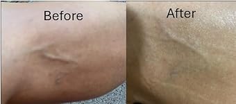 Review Image by JR JR