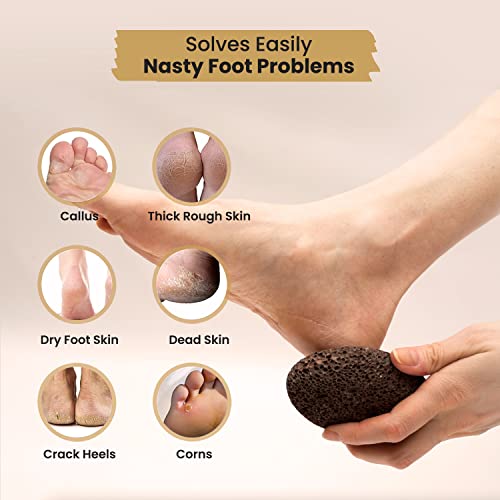 Pumice Stone for Feet - Dead Skin and Callus Remover for Feet - Natural Brown Volcanic Lava Stone Eco-Friendly